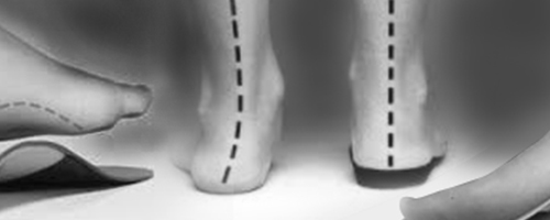 Shoes Type that fit Orthotics - The Podiatry Centre
