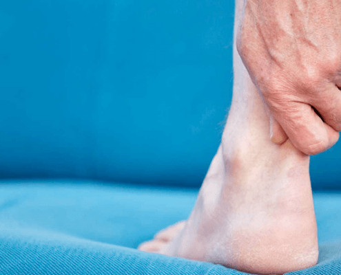 Achilles Tendonitis