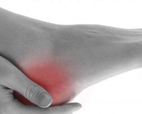 Heel Pain